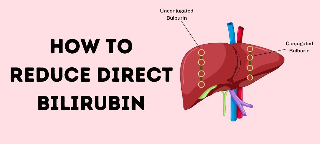 How to reduce direct bilirubin Unconjugated Bilirubin Conjugated Bilirubin